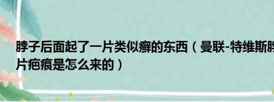 脖子后面起了一片类似癣的东西（曼联-特维斯脖子上的一片疤痕是怎么来的）