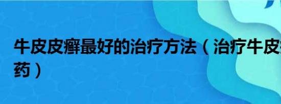 牛皮皮癣最好的治疗方法（治疗牛皮癣最好的药）